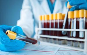 Ferritin Nedir? Ferritin Seviyesi Nasıl Olmalı? Yüksekliği ve Düşüklüğü Sağlığınızı Nasıl Etkiler?