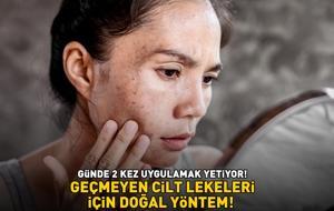 GEÇMEYEN CİLT LEKELERİ İÇİN DOĞAL YÖNTEM! Günde 2 kez uygulamak yetiyor! Güneş lekesi ve sivilce izlerini silip süpürüyor!