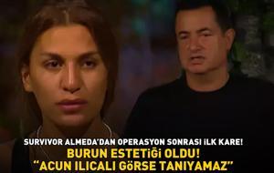 BURUN ESTETİĞİ OLDU! Survivor Almeda sosyal medyayı 2'ye böldü! 'Acun Ilıcalı görse tanıyamaz!'