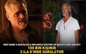 Euphoria'nın yıldızı Eric Dane o hastalıkla mücadele ediyor! Bu belirtilere dikkat! 100.000 KİŞİNİN 3 İLA 8'İNDE GÖRÜLÜYOR!