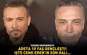 Yüzünü gerdirmişti! Adeta 10 yaş gençleşti! Cenk Eren'in son hali gündem oldu