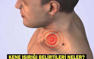 KENE ISIRIĞI BELİRTİLERİ: Kene ısırığı nasıl belli olur? Kene ısırığında ilk yapılması gereken nedir? Keneden korunmak için ne yapmalıyız?