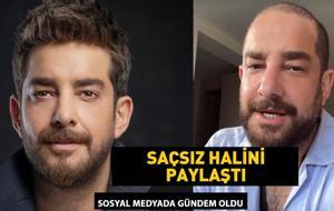 Enis Arıkan'ın saçsız hali gündem oldu! Meğer protez saç kullanıyormuş!