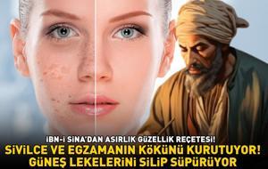 İbn-i Sina'dan asırlık güzellik reçetesi! 3 malzeme ile hazırlanıyor: 'Sivilce ve egzamanın kökünü kurutuyor, güneş lekelerini silip süpürüyor'