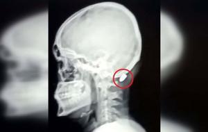 Çoğu Zaman Fark Edilmiyor, Tesadüfen Bulunuyor! Uzman İsimden Hayati Uyarı: Silah Sesi Duyduğunuzda Balkona Pencereye Koşmayın