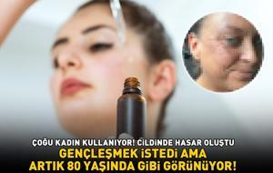 CİLDİNDE HASAR OLUŞTU! Çoğu kadın kullanıyor! Gençleşmek istedi ama artık 80 yaşında gibi görüyor!