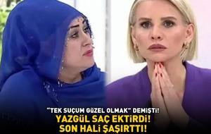 Esra Erol'un programında 'Tek suçum güzel olmak' demişti! Saç ektiren Yazgül'ün son hali şoke etti!