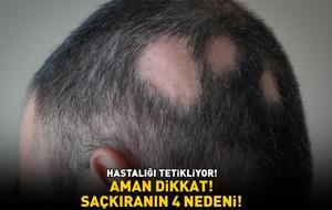 SAÇKIRANIN 4 NEDENİ! Kaşıntı, kızarıklık, halka şeklinde döküntü... Aman dikkat! Hastalığı tetikliyor