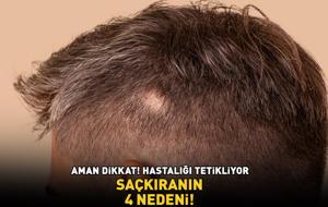 Aman dikkat! Hastalığı tetikliyor! SAÇKIRANIN 4 NEDENİ!