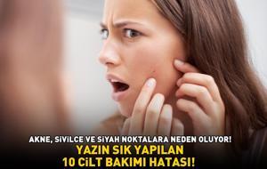 YAZIN SIK YAPILAN 10 CİLT BAKIMI HATASI! Akne, sivilce ve siyah noktalara neden oluyor!