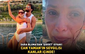 Can Yaman’ın büyük aşkı Sara Bluma kanlar içinde! Ünlü oyuncu, şiddet gören sevgilisine böyle destek verdi: 'YANINDAYIM!'