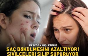KEPEĞE KARŞI ETKİLİ! Saç dökülmesini azaltıyor; ciltteki bakteriyel sorunları, akne ve sivilceleri silip süpürüyor!