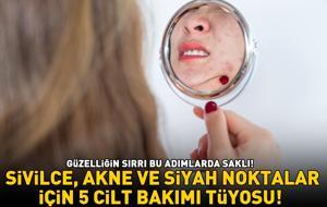 GÜZELLİĞİN SIRRI BU ADIMLARDA SAKLI! Sivilce, akne ve siyah noktalar için 5 cilt bakımı tüyosu!