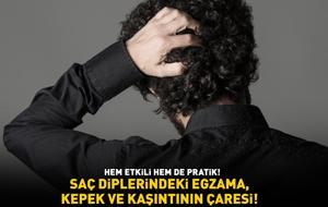 Haftada 2 kez mutlaka uygulayın! Egzamanın neden olduğu kaşıntıyı azaltıyor, kepek sorununun önüne geçip saç derisini ferahlatıyor