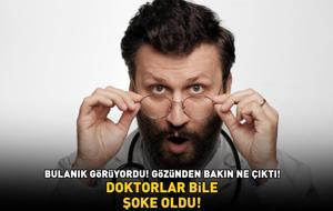 DOKTORLAR BİLE ŞOKE OLDU! 8 ay boyunca bulanık gören adamın gözünden bakın ne çıktı!