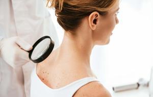 Soğuk Havada Cilt Kuruluğu Masum Değil! Altından Ciddi Sorunlar Çıkabilir