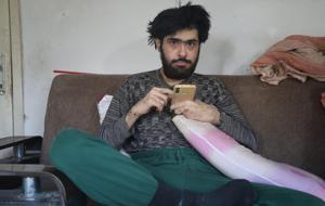 Türkiye ona üzülmüşü! Hatay'da 3 yıl sonra duş alıp, tıraş olan Barış'a teşhis konuldu