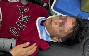 Erzurum'da okul çıkışı feci olay: 23 öğrenci yaralandı