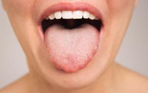 Dildeki Renk, Doku ve Şekil Değişikliklerine Dikkat! Demir Eksikliğinden Enfeksiyonlara... Bu Hastalıkların Sinyali Olabilir