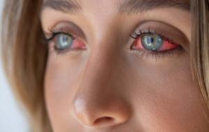 Gözlerde kaşınma, kızarma ve batma... Bu belirtilerle kendini gösteriyor! Sonbahar alerjilerine dikkat