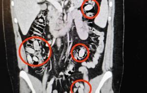 Polisin şüphesi üzerine durduruldu! Midesinden çıkanlar şoke etti