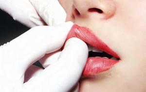 Dolgu ve Botoksun Karanlık Yüzü: 100 Kişide Ortak Sonuç: Damarlardaki Kan Akışını Durduruyor! Yan Etkileri Korkunç