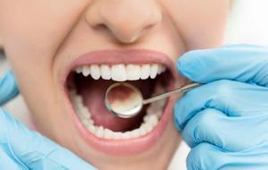 Sessizce Yaşlandırıyor! Eksik Diş, 10 Yıl Daha Yaşlı Görünüm Demek