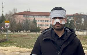 Eskişehir'de okulda skandal olay! Öğretmen, meslektaşının yüzüne sıcak çay fırlattı