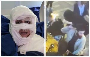 Oraya gidince saçlarını yakma isteği doğdu