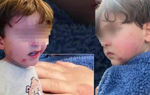 Özel kreşte skandal! 2,5 yaşındaki çocuğa darp