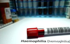 Uzun süren kanamalar en önemli belirti! Hayat boyu sürüyor, erken farkındalık hayat kurtarıyor