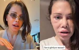Didem Ceran’dan dikkat çeken paylaşım! “Bu bir estetik değil, yeniden doğuş”