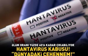 HANTAVİRÜS KABUSU! Ölüm oranı yüzde 60'a kadar çıkabiliyor! Hastalıkla savaşanlar noktayı koydu: 'Dünyadaki cehennem'
