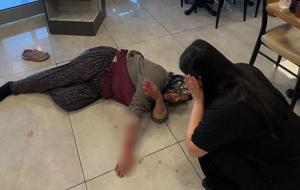 Dinlenme tesisinde dehşet! Sahipsiz köpek kolunu kopardı