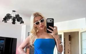 İrem Derici’nin serçe parmağındaki değişimin nedeni ortaya çıktı!
