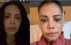 Yüz nakli sonrası değişimiyle gündemdeydi! Didem Ceran kendisini dünyaca ünlü yıldızla kıyasladı
