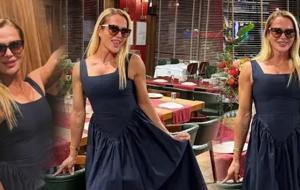 Survivor 2026 ikincisi Nagihan Karadere’den yeni paylaşım! Estetik sonrası son hali dikkat çekti