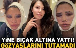 Yüz nakli olan Survivor Didem Ceran, bir kez daha bıçak altına yattı! Gözyaşlarını tutamadı