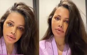 İkinci kez kapsamlı yüz operasyonu geçirmişti! Didem Ceran'dan duygusal paylaşım: En iyi niyetli olduğum yerlerden cezalandırıldım