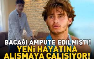 Bacağı ampute edilmişti! Survivor Yunanistan'ın şampiyonu Stavros Floros yeni hayatına alışmaya çalışıyor