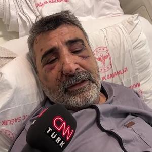 İngiliz boksörün darp ettiği taksici CNN TÜRKte: Türkiyede yargılanmasını istiyorum