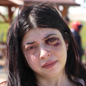 Sokak ortasında darbedilen Damla: Platinler hep yüzümde kalacakmış