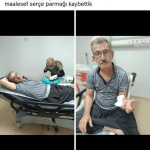 Karpuz keserken parmağını kesti
