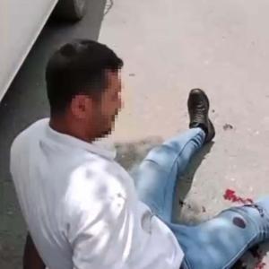 Kendisini rahatsız eden kişiyi bacağından yaralayıp sosyal medyada paylaştı; tutuklandı