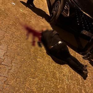 Sokakta yürürken tabanca ile başından vuruldu