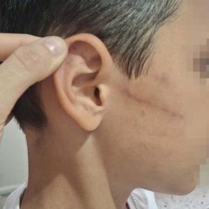 Babasının darbettiği 12 yaşındaki çocuk koruma altına alındı