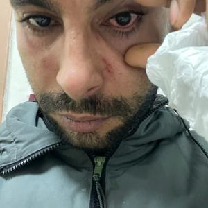 Hastaya yumruk attığı iddiasıyla doktora dava