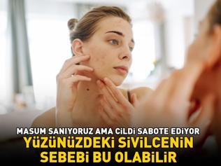 Yüzünüzdeki Sivilcenin Sebebi Bu Olabilir Masum Sandığınız O Yiyecekler Cildinizi Sabote Edip Akneye Davetiye Çıkarıyor
