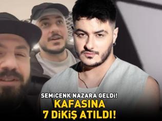 SEMİCENK NAZARA GELDİ Korkutan kaza Ünlü rapçinin kafasına 7 dikiş atıldı
