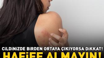 Cildinizde Birden Ortaya Çıkıyorsa Dikkat Ürtikerin 5 Gizli Tetikleyicisi